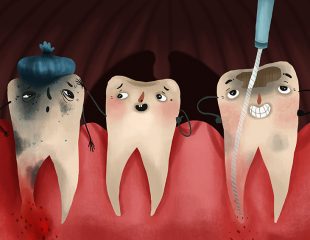 درمان ریشه دندان یا روت کانال