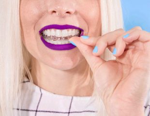 ارتودنسی نامرئی چیست؟ سایت دندانپزشکی دندانه