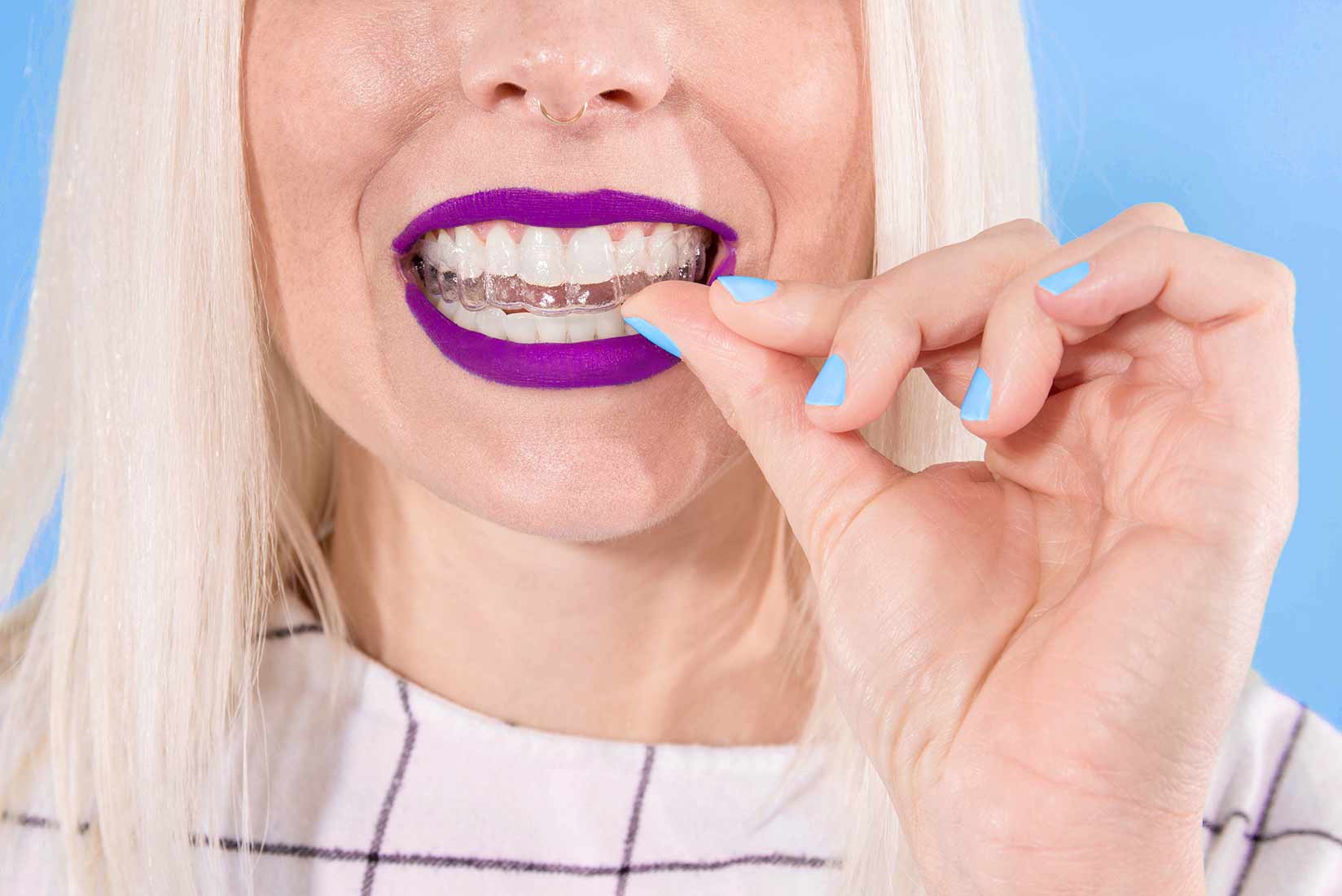 invisible aligners or braces invisible aligners or braces