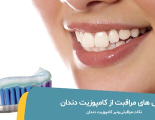 روش های مراقبت از کامپوزیت دندان