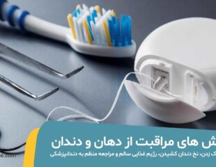 روش های مراقبت از دهان و دندان