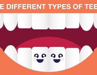انواع دندان