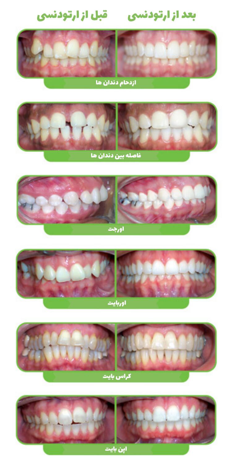 اینفوگرافی رایج ترین مشکلات ارتودنسی