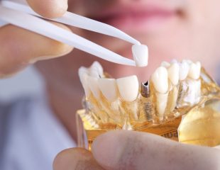 بهترین متخصص ارتودنسی دندان در تهران