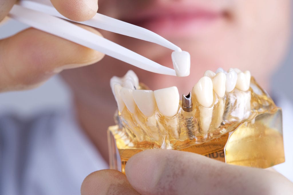 بهترین متخصص ارتودنسی دندان در تهران