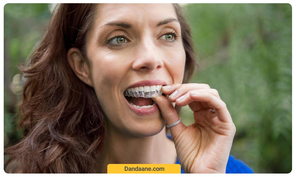 یک خانم در حال گذاشتن پلاک ارتودنسی متحرک روی دندان های فک بالا