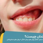 عکس آبسه دندان در کودکان