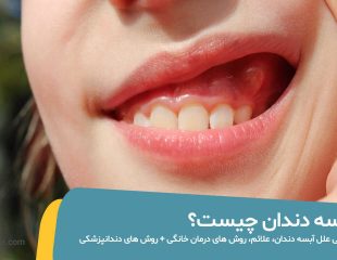 عکس آبسه دندان در کودکان