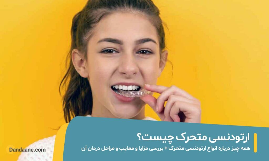 ارتودنسی متحرک عکس