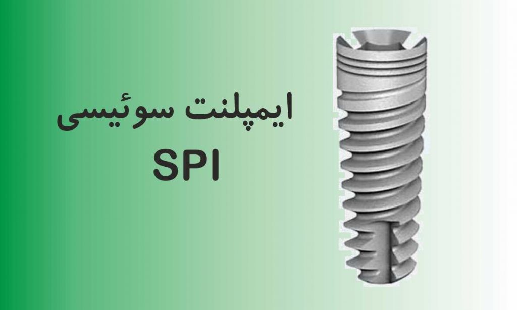 ایمپلنت سوئیسی SPI