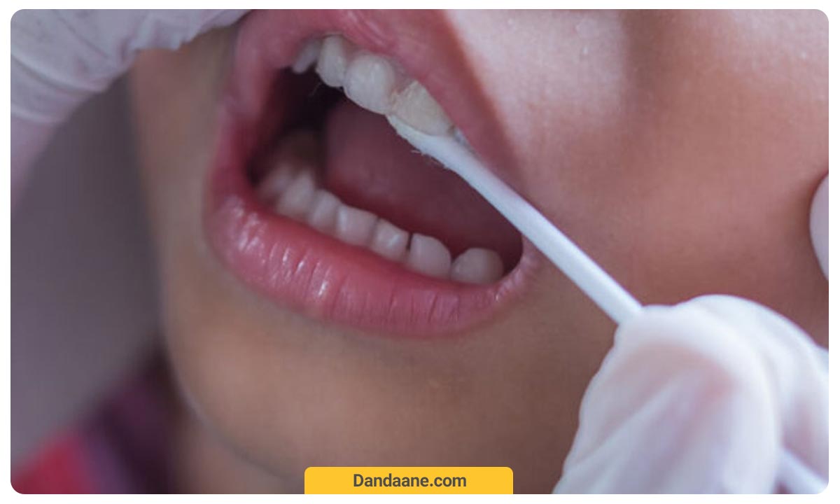 تمیز کردن دندان کودک برای فلوراید تراپی