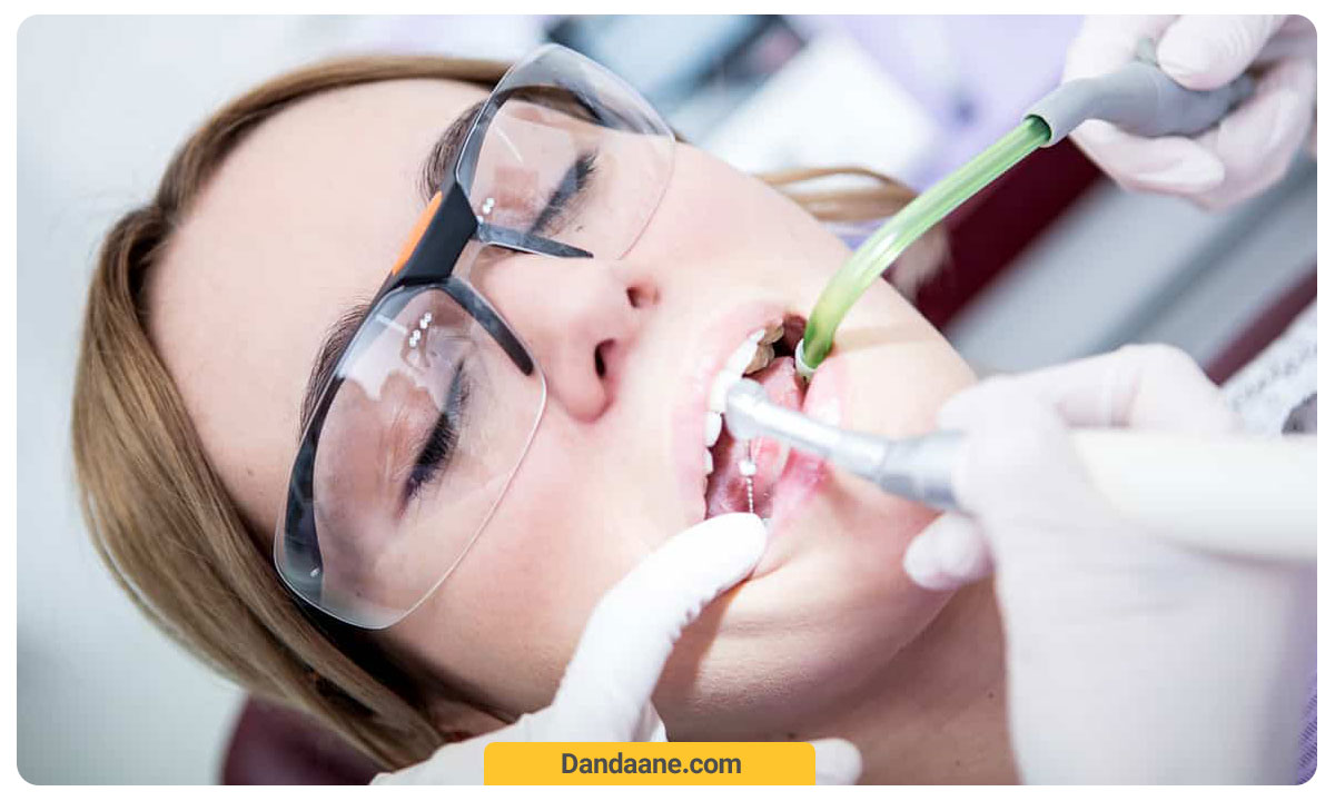 انجام عصب کشی دندان توسط دندانپزشک