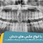 شاخص انواع عکس دندان (opg و ...)