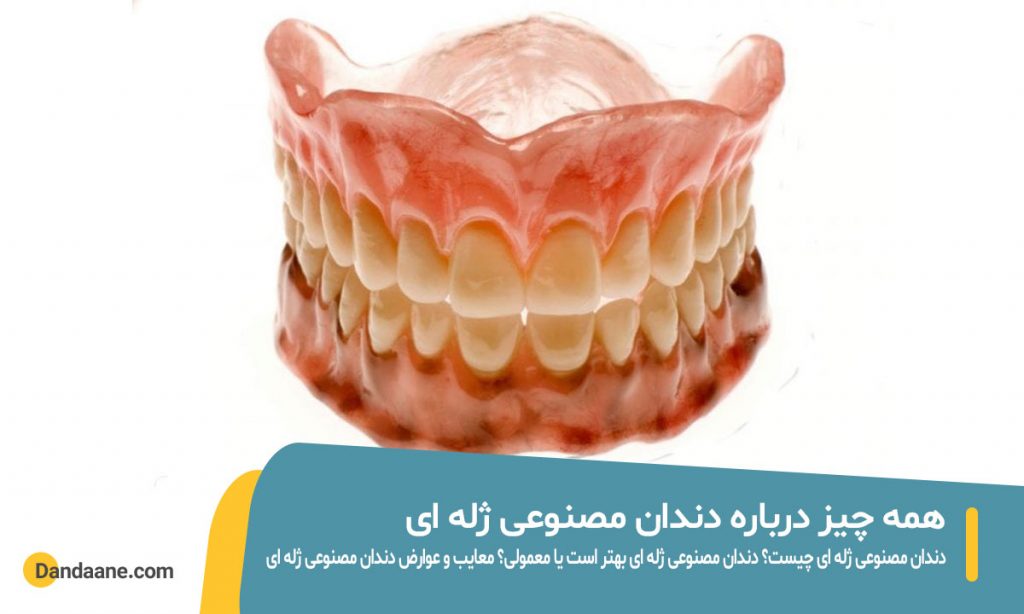 همه چیز درباره دندان مصنوعی ژله ای