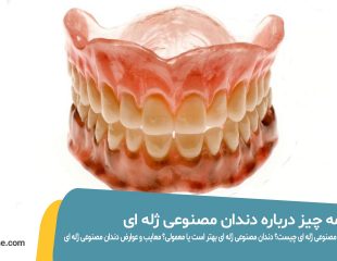 همه چیز درباره دندان مصنوعی ژله ای