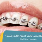 هزینه ارتودنسی ثابت دندان چقدر است؟