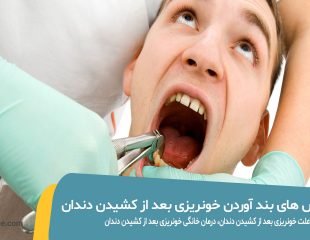 روش های بند اوردن خونریزی بعد از کشیدن دندان
