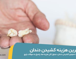 هزینه و قیمت کشیدن دندان