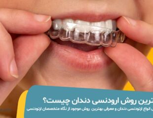 بهترین روش ارتودنسی دندان عکس