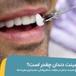 هزینه لمینت دندان عکس