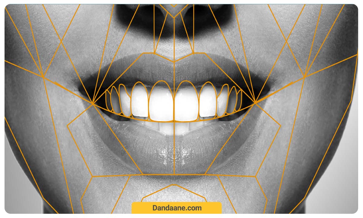 اقداات لازم برای اصلاح طرح لبخند