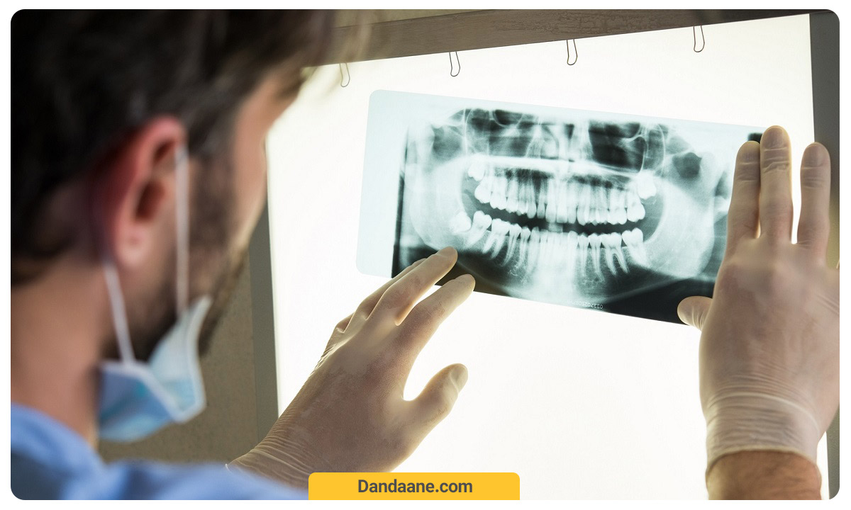 تعرفه دندانپزشکی-عکس دندان