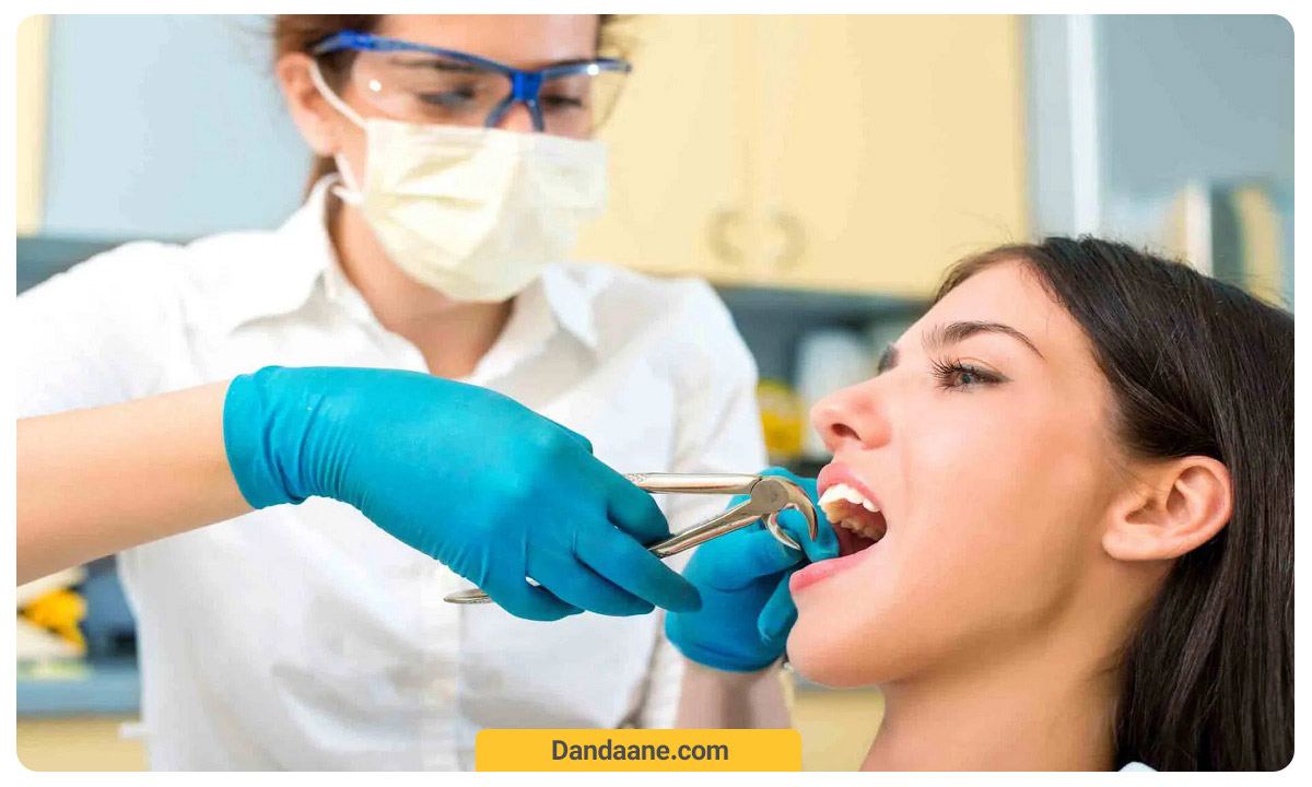 کشیدن دندان به روش معولی