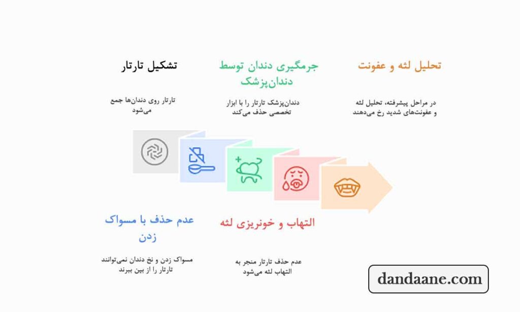 جرمگیری دندان چیست