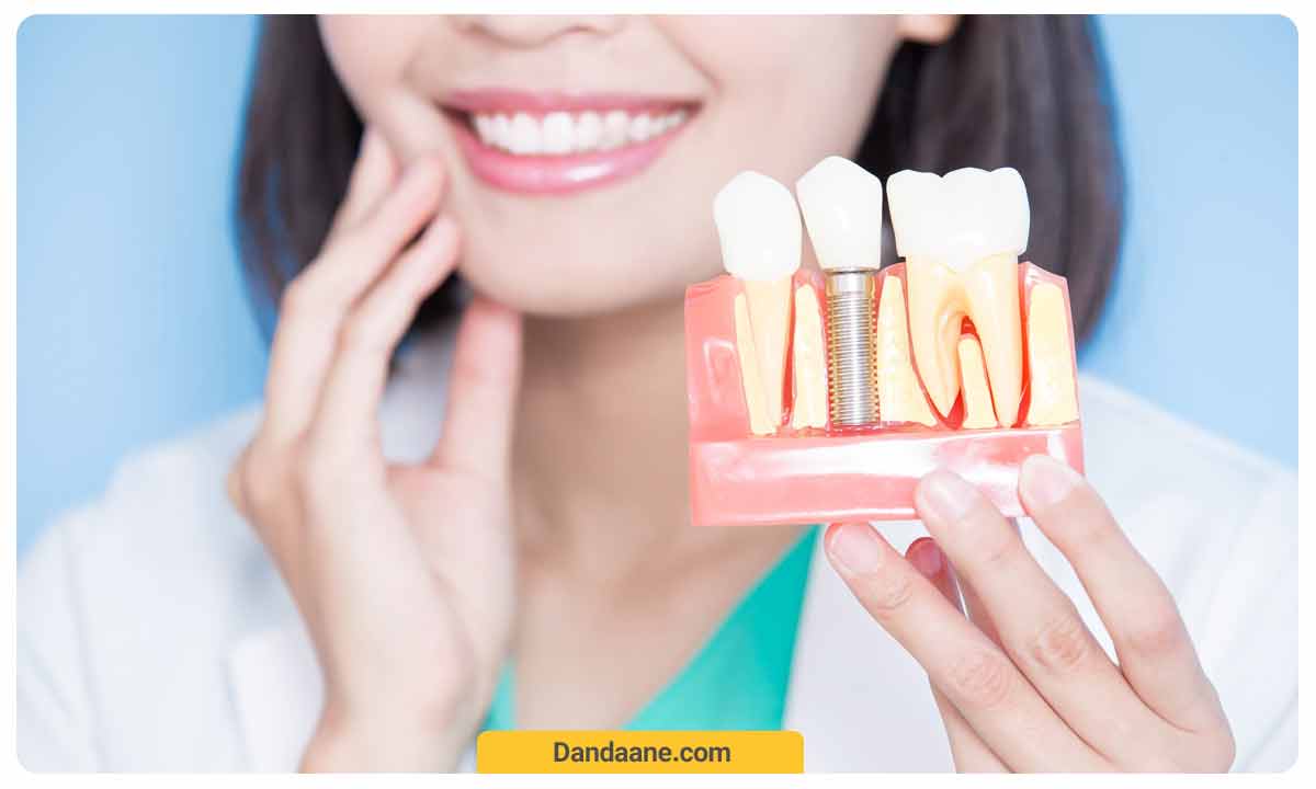 عوارض کاشت ایمپلنت دندان