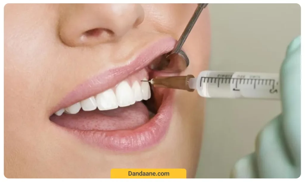 تزریق داروی بی حسی به دندان