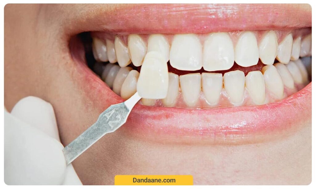 تصویر کامپوزیت میکروفیل