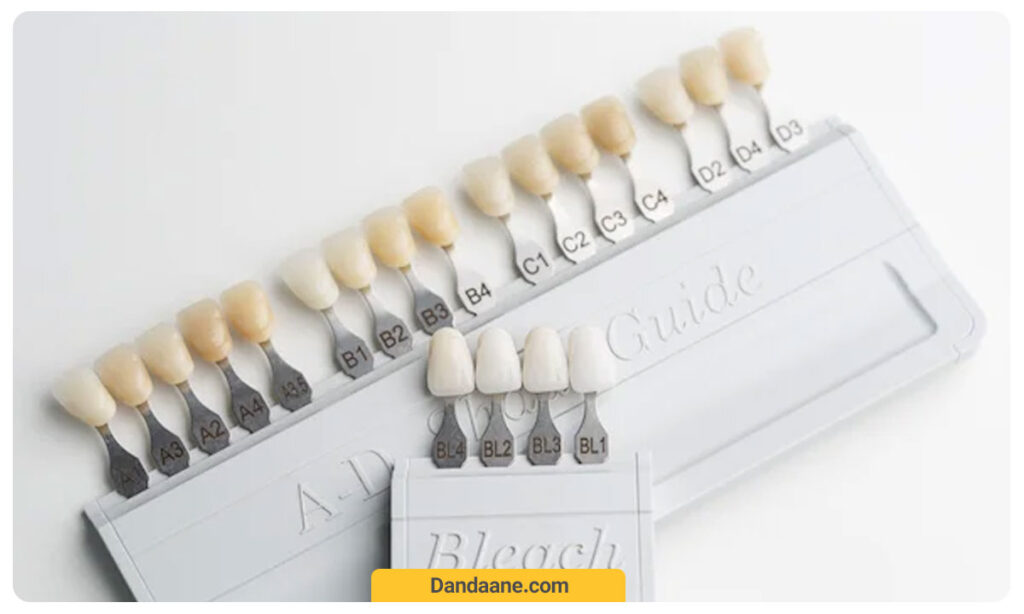 عکس روکش های سرامیکی