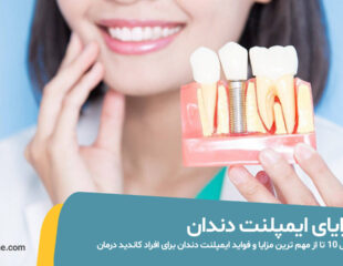 مزایای ایمپلنت دندان