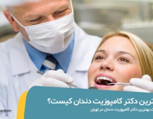 بهترین دکتر کامپوزیت دندان