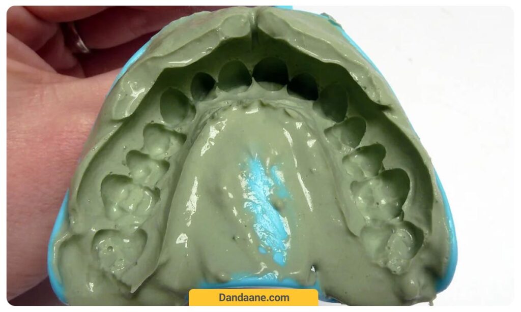 عکسی از قابل گیری لمینت