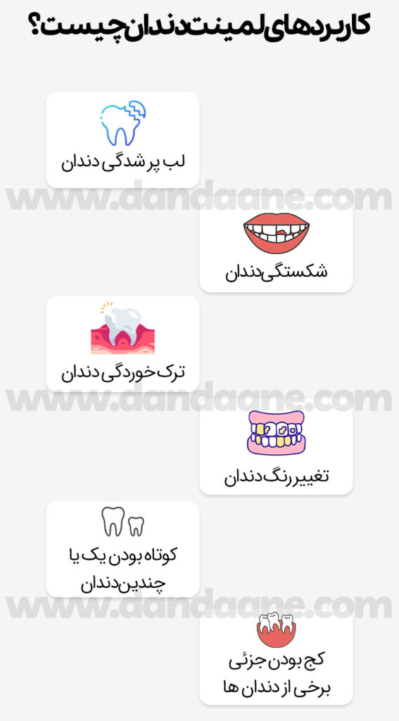 کاربرد لمینت دندان