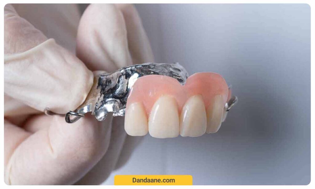 عکس دندان مصنوعی برای افراد جوان