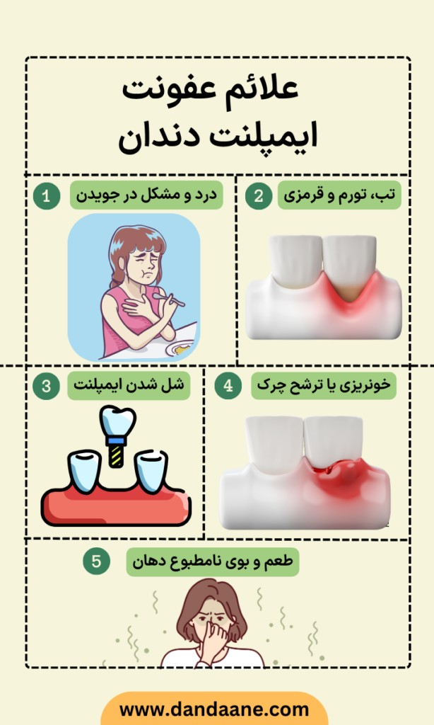 اینفوگرافی عفونت ایمپلنت دندان