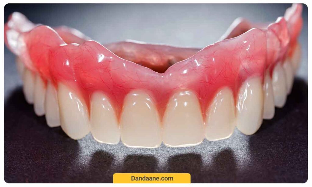 دندان مصنوعی سرامیکی