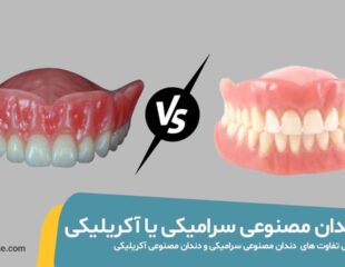 دندان مصنوعی سرامیکی بهتر است یا آکریلیکی