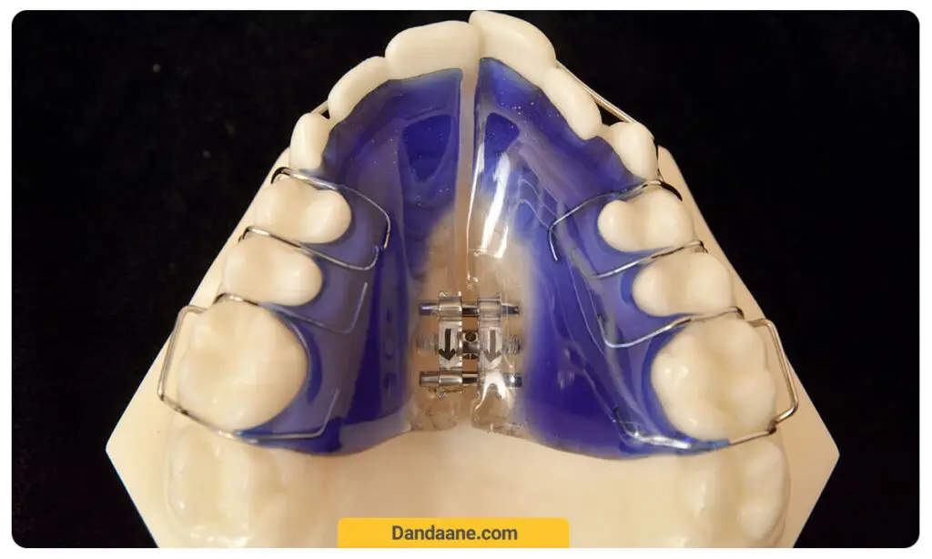 تصویر وسیع کننده کام 