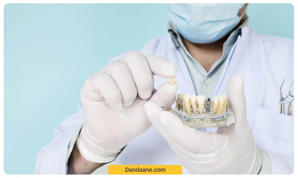 متخصص ایمپلنت در حال نشان دادن ایمپلنت دندان جلو