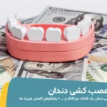 هزینه عصب کشی دندان