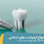 شاخص هزینه و قیمت ایمپلنت دندان
