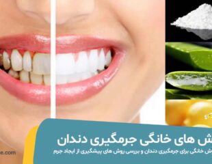 روش های خانگی جرمگیری دندان