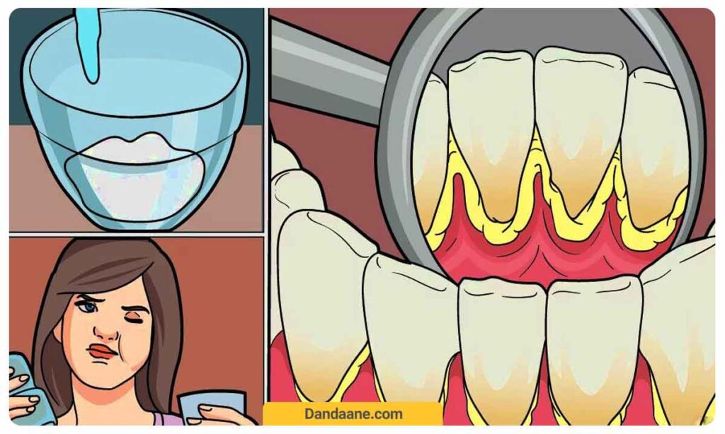 تصویر کارتونی از جرم دندان و خانومی که در حال استفاده از دهانشویه می باشد