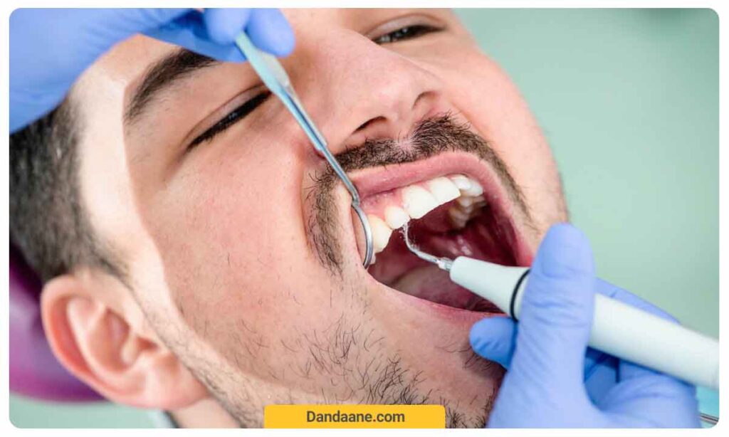 تصویر بیمار مرد در حال جرمگیری دندان توسط دندانپزشک