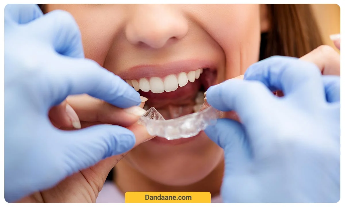 تصویر دندانپزشک که در حال جایگذاری ارتودنسی نامرئی در دهان بیمار است