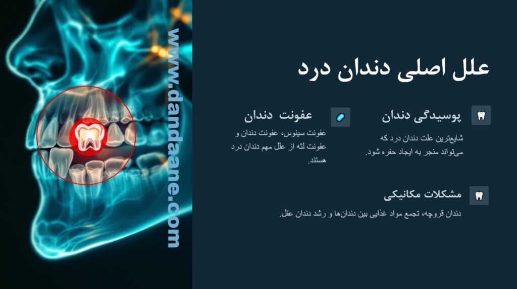 تصویر اینفوگرافی از علت دندان درد 