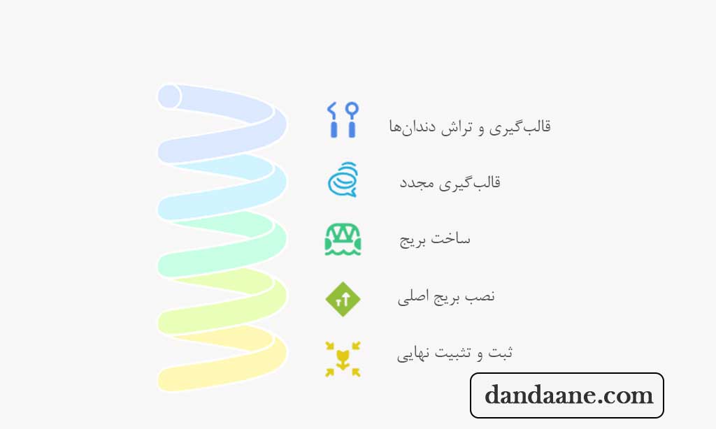 مراحل نصب بریج دندان